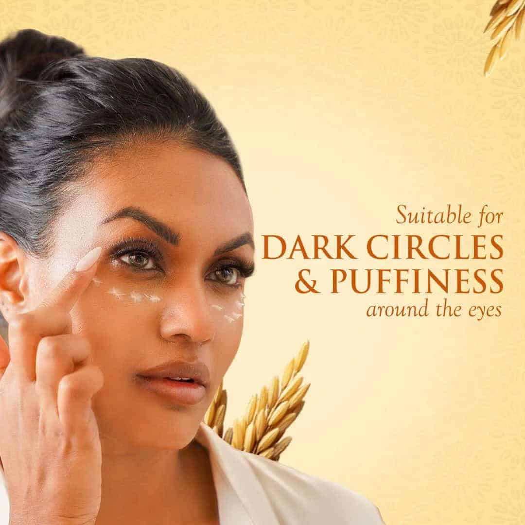 Bright woman with dark circles around her eyes promoting Spa Ceylon skincare products for dark circles and puffiness.